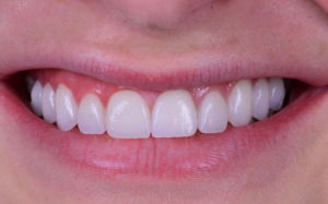 cosmetic dentist Los Angeles