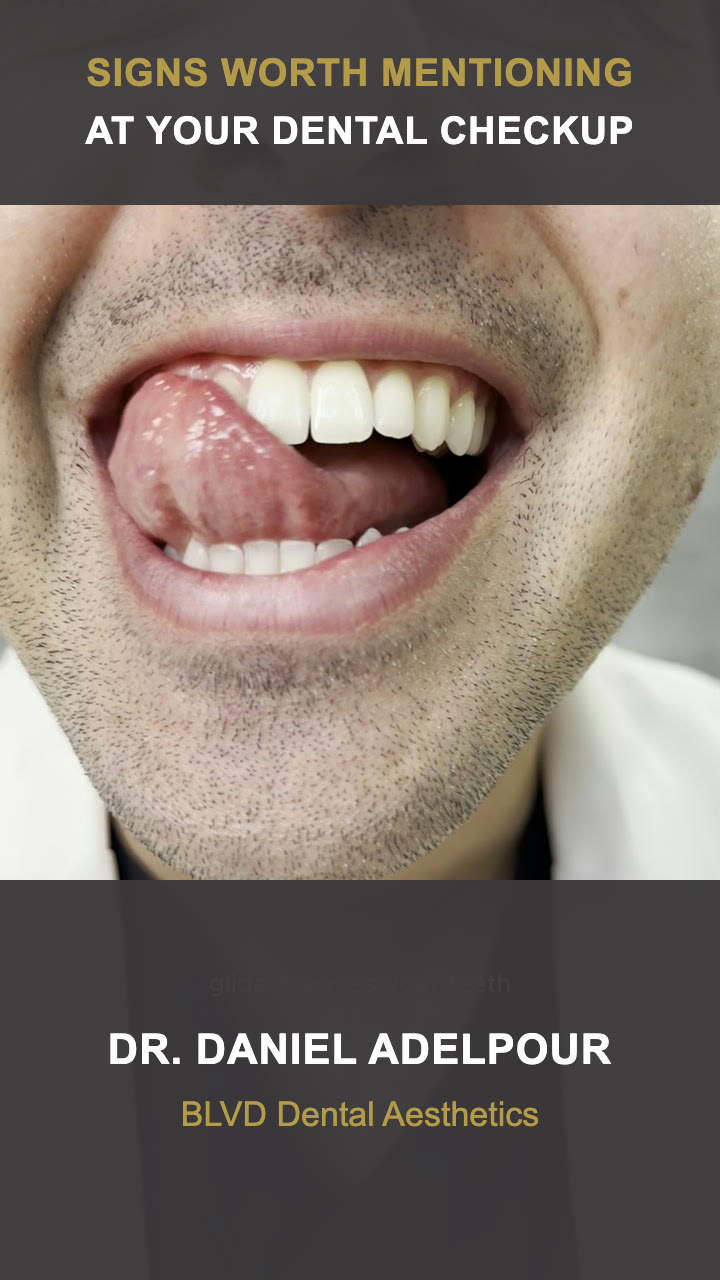 Dr. Daniel Adelpour discussing signs that may mean a patient is due for a dental cleaning